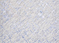 LIMAN F164 CREAM-BLUE
